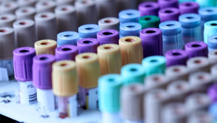 A medical testing kit with many colourful tubes